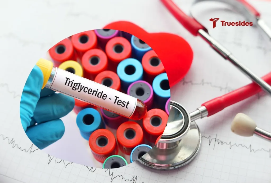 Triglyceride Levels Test
